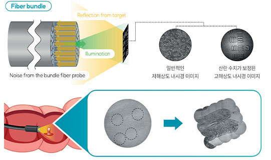 Fiber Endoscopy